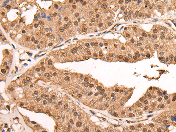 Rabbit Polyclonal Antibody to ATRIP