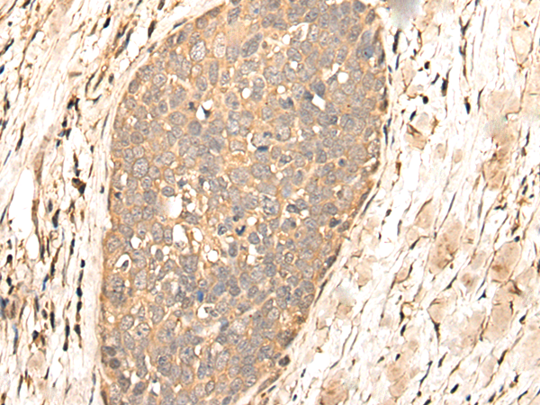 Rabbit Polyclonal Antibody to BAALC