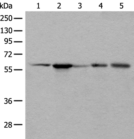 Rabbit Polyclonal Antibody to BAIAP2L1