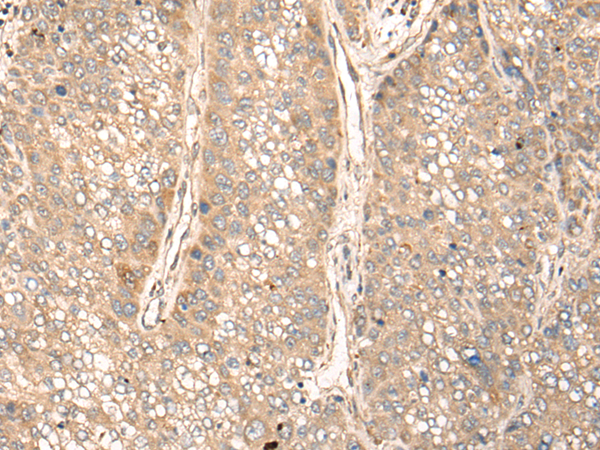 Rabbit Polyclonal Antibody to GPANK1
