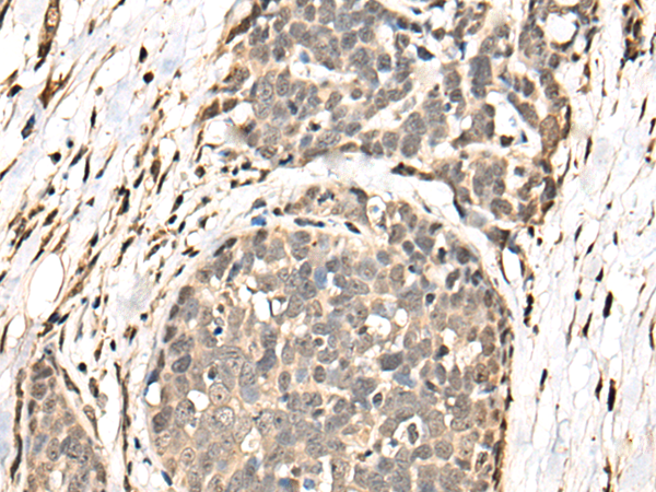 Rabbit Polyclonal Antibody to BATF