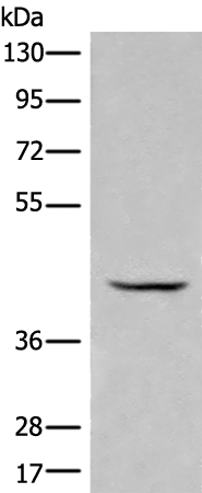 Rabbit Polyclonal Antibody to BBOX1