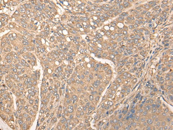 Rabbit Polyclonal Antibody to BBS1