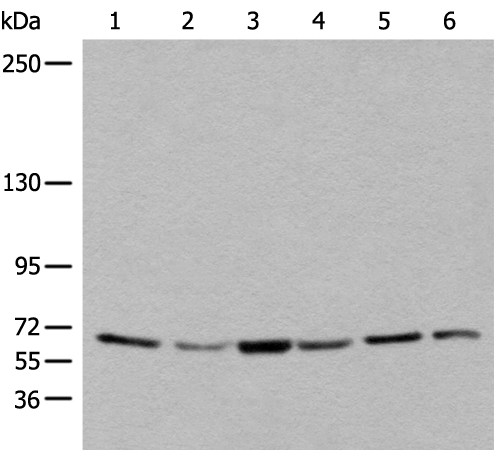 Rabbit Polyclonal Antibody to BBS10