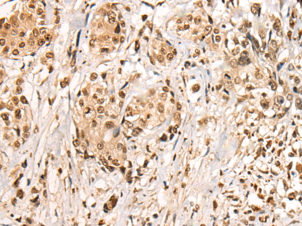 Rabbit Polyclonal Antibody to BBX