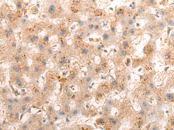 Rabbit Polyclonal Antibody to BCKDK