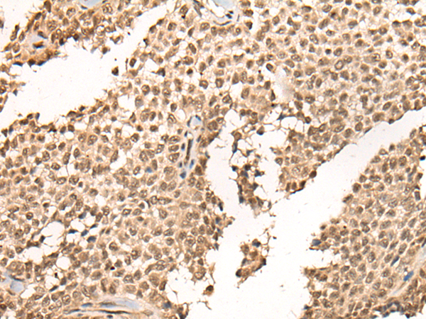 Rabbit Polyclonal Antibody to BCL6B