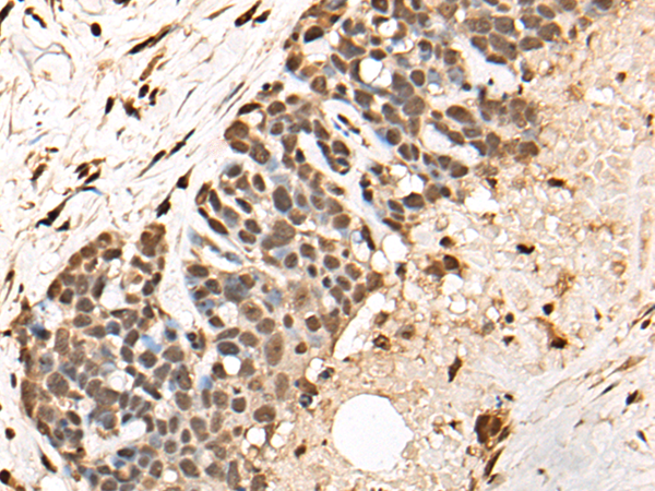 Rabbit Polyclonal Antibody to BCL9