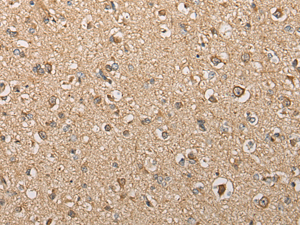 Rabbit Polyclonal Antibody to BCO2