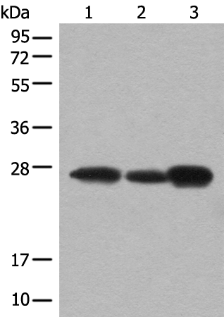 Rabbit Polyclonal Antibody to BDH2