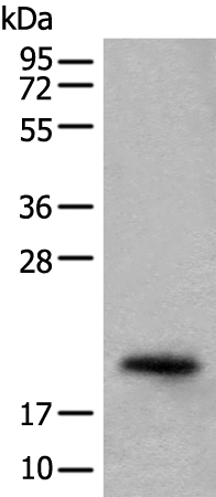 Rabbit Polyclonal Antibody to CRYGS