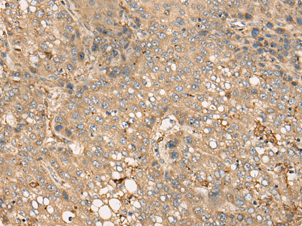 Rabbit Polyclonal Antibody to BEX1
