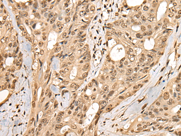 Rabbit Polyclonal Antibody to PHF21A