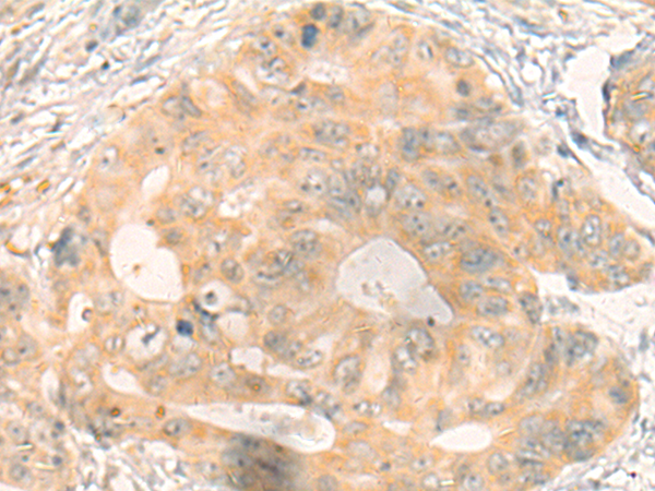 Rabbit Polyclonal Antibody to BLVRA