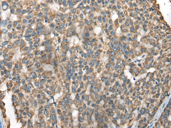 Rabbit Polyclonal Antibody to BLNK