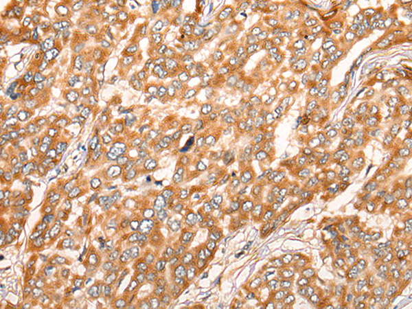 Rabbit Polyclonal Antibody to ZMYND10