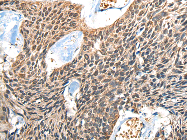 Rabbit Polyclonal Antibody to BOLA1