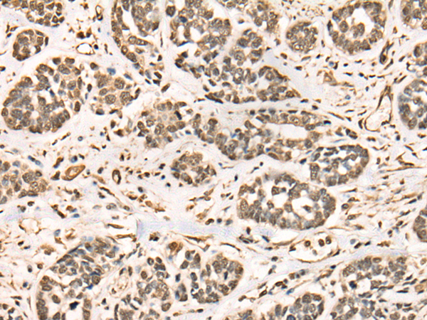 Rabbit Polyclonal Antibody to BRD7