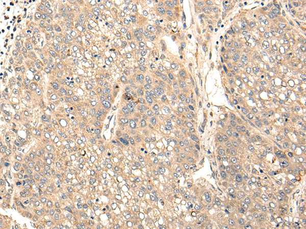 Rabbit Polyclonal Antibody to STAP1