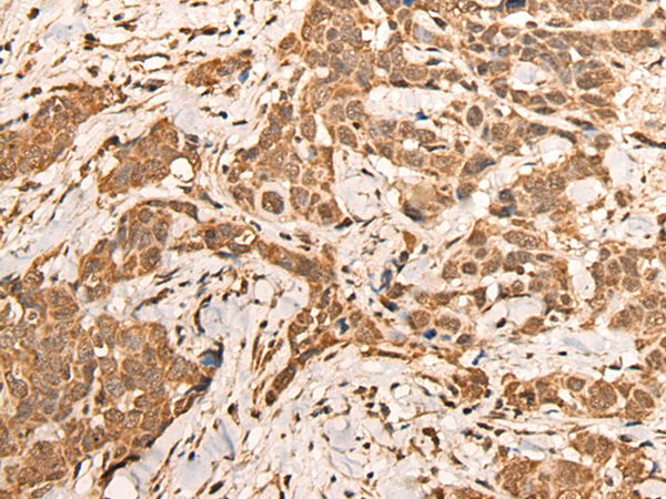 Rabbit Polyclonal Antibody to BRF2
