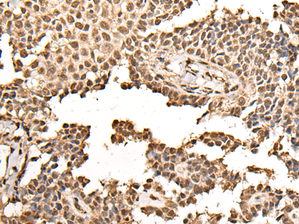 Rabbit Polyclonal Antibody to BRF1