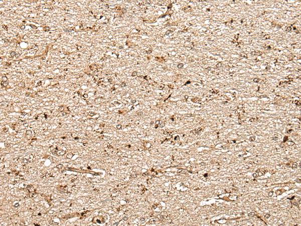 Rabbit Polyclonal Antibody to MCPH1
