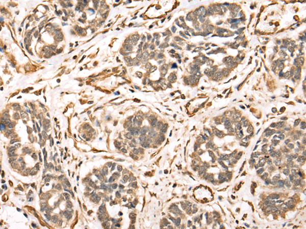 Rabbit Polyclonal Antibody to BRPF3