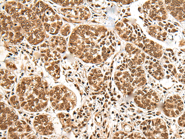 Rabbit Polyclonal Antibody to BRSK1