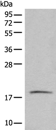 Rabbit Polyclonal Antibody to BTF3L4