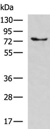 Rabbit Polyclonal Antibody to BTK