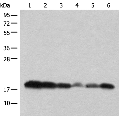 Rabbit Polyclonal Antibody to BUD31