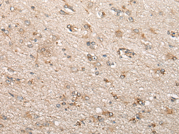 Rabbit Polyclonal Antibody to BCHE