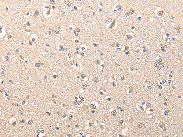 Rabbit Polyclonal Antibody to C12orf40