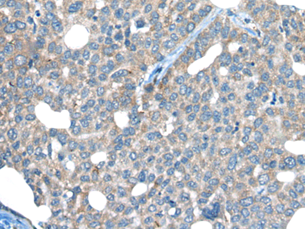 Rabbit Polyclonal Antibody to INF2