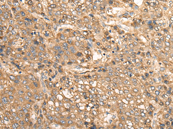Rabbit Polyclonal Antibody to MEIOB