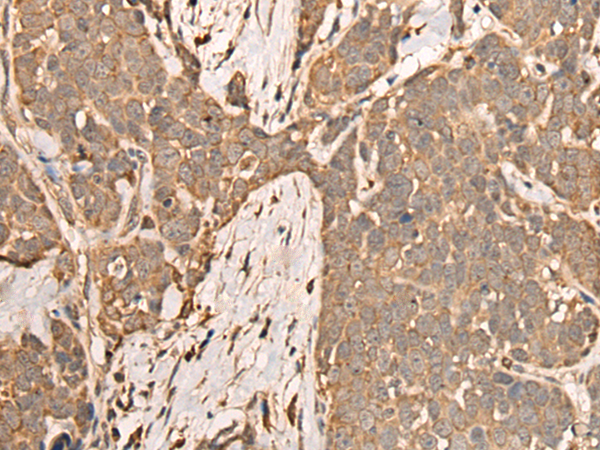Rabbit Polyclonal Antibody to C17orf67