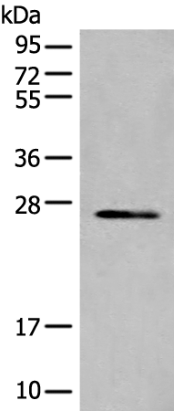 Rabbit Polyclonal Antibody to TIMM21