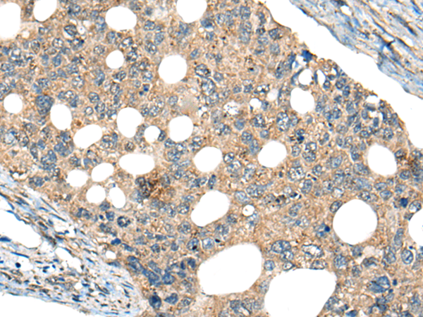 Rabbit Polyclonal Antibody to RMC1