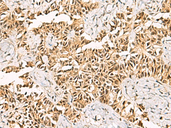 Rabbit Polyclonal Antibody to LRIF1