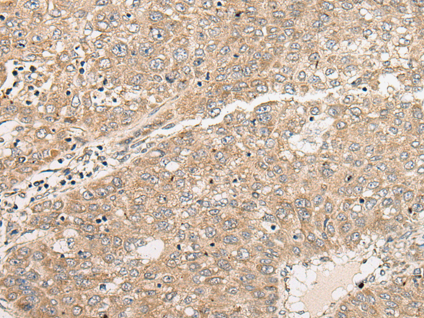Rabbit Polyclonal Antibody to CATSPERE