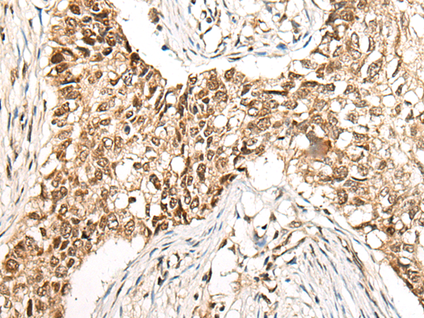 Rabbit Polyclonal Antibody to CCDC181