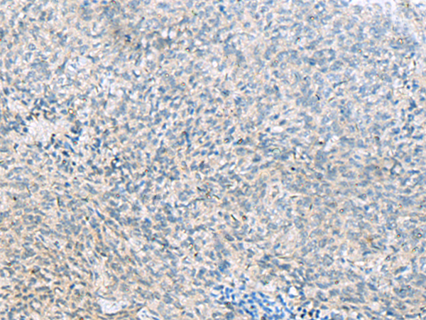 Rabbit Polyclonal Antibody to C1orf112