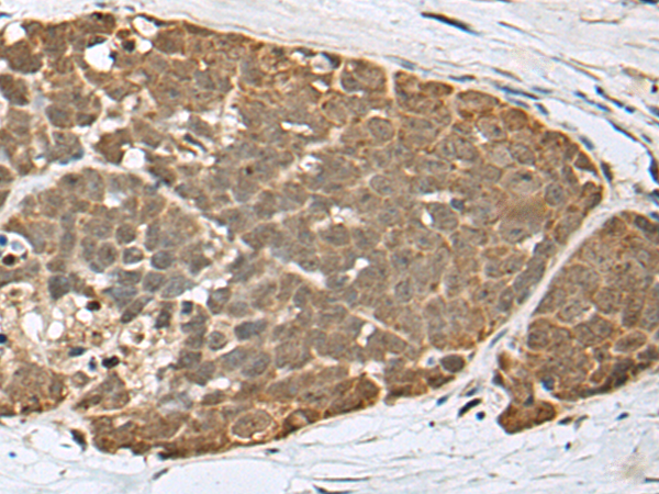 Rabbit Polyclonal Antibody to SPRTN