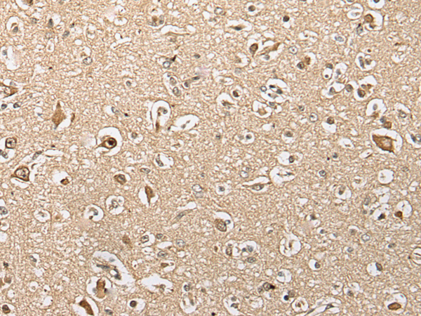 Rabbit Polyclonal Antibody to TSEN15