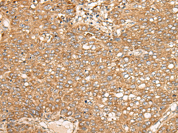 Rabbit Polyclonal Antibody to EDEM2
