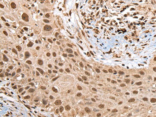 Rabbit Polyclonal Antibody to RTCB