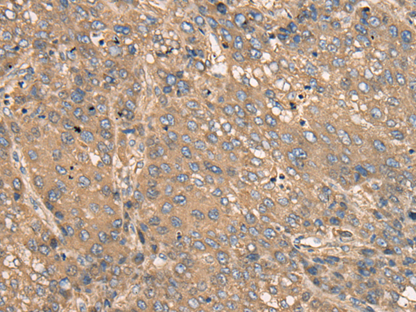 Rabbit Polyclonal Antibody to C2CD2