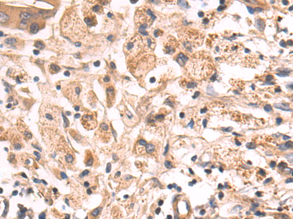 Rabbit Polyclonal Antibody to KLHL12