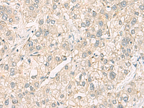 Rabbit Polyclonal Antibody to C3orf38