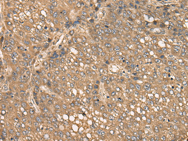 Rabbit Polyclonal Antibody to C4BPB